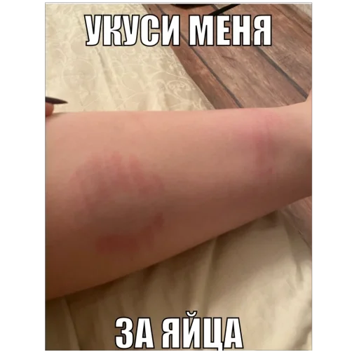 Sticker Vonyaesh9 - 1