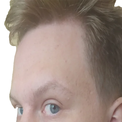 Sticker D'ANAL'A - 9