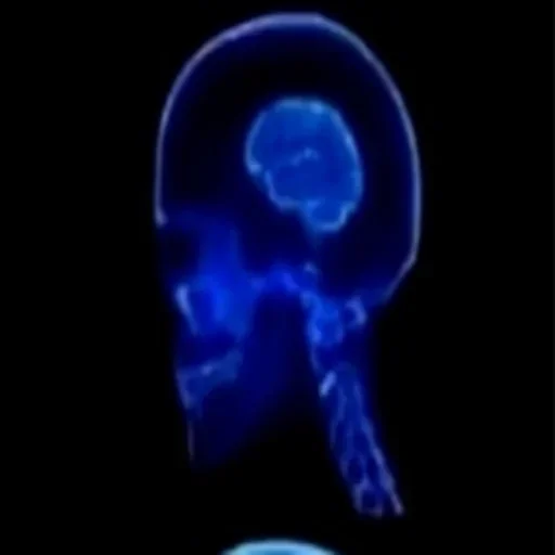 animal invertebrate jellyfish