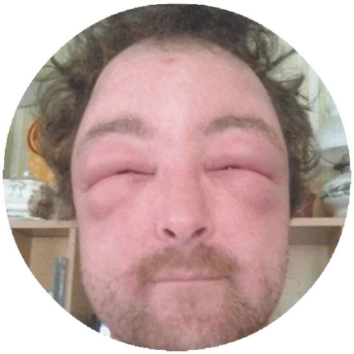 человеческое лицо лоб щека