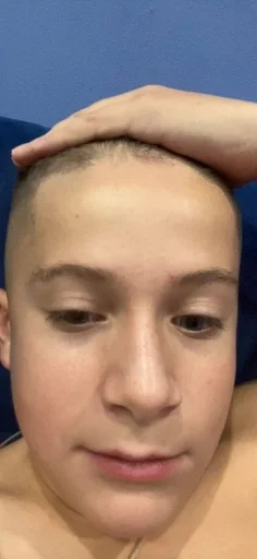 Человек человеческое лицо кожа