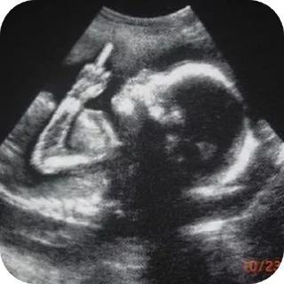 Стикер Бибизянычичичи - 2