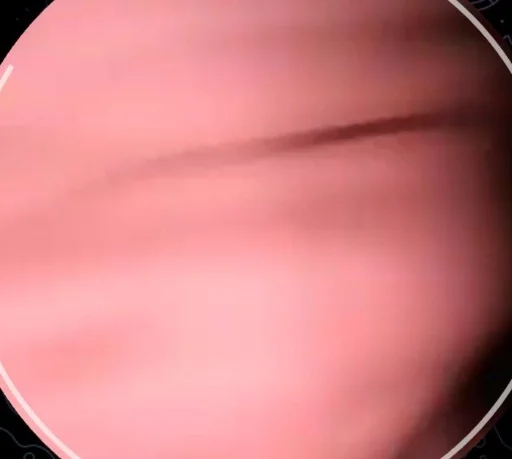 circle dishware abstract