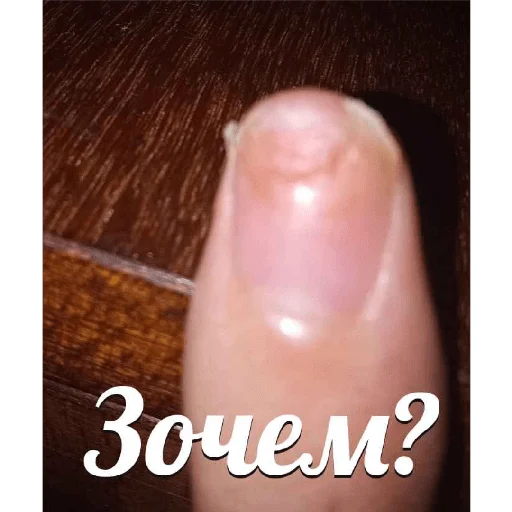 Ноготь - 