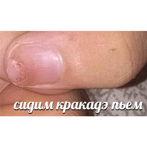 Sticker BotPizdit - 1