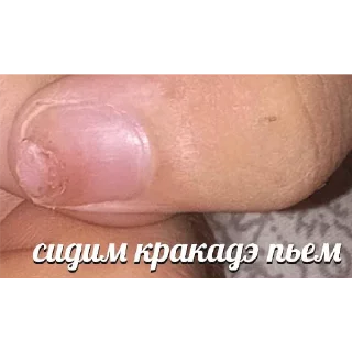 Sticker Ноготь - 5