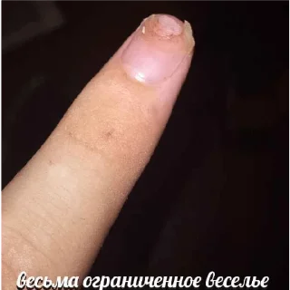 Sticker Ноготь - 1