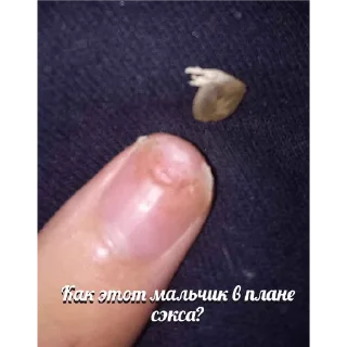 Sticker Ноготь - 0