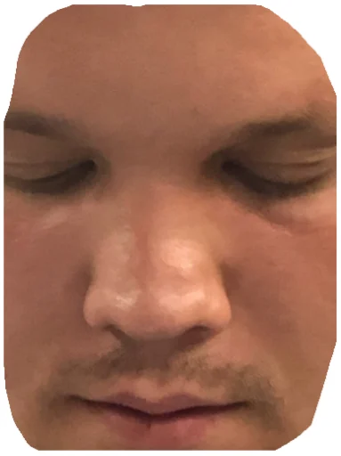 human face forehead cheek