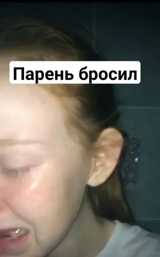 СМС челюсть кожа