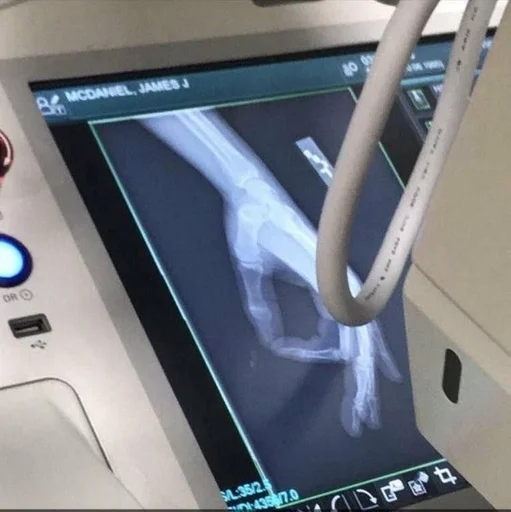 дисплейное устройство монитор мультимедиа