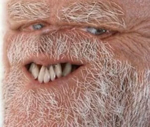 человеческая борода кожа волосы на лице