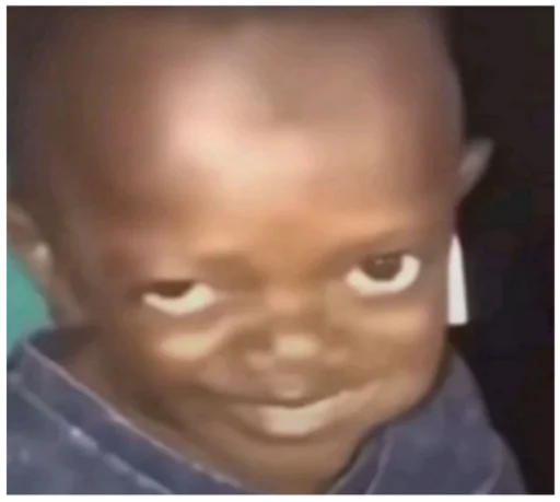 Человек щека кожа