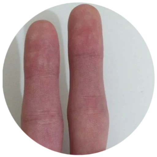 Sticker GoryachieRuki - 1