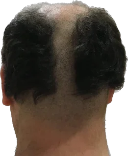 Sticker Казлы - 2