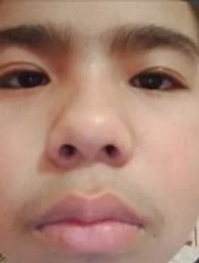 человеческое лицо кожа Человек