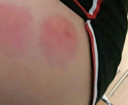 Человек плоть Назад