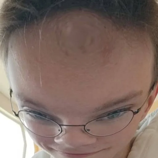 person eyebrow human face