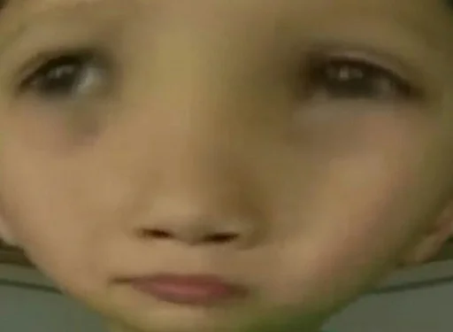 бровь кожа ресница