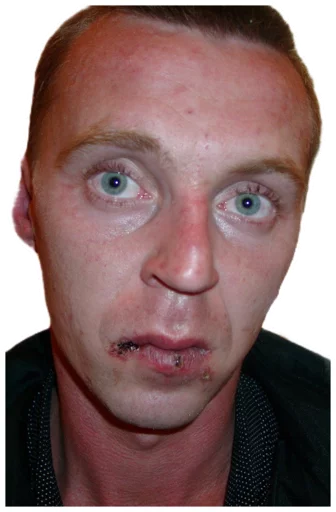 человеческое лицо Человек лоб