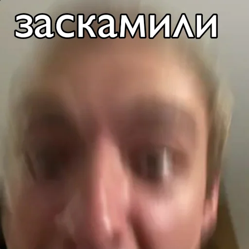 skin forehead eyebrow