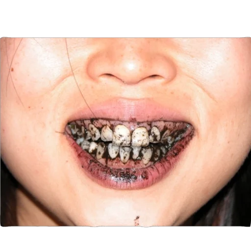 Sticker Ottepel7 - 1