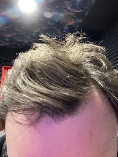 Стикер Самарская алопеция - 9