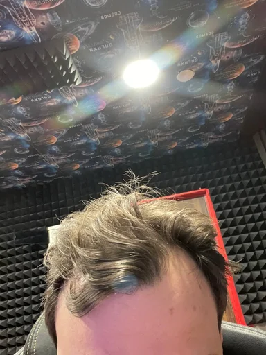 Стикер Самарская алопеция - 8