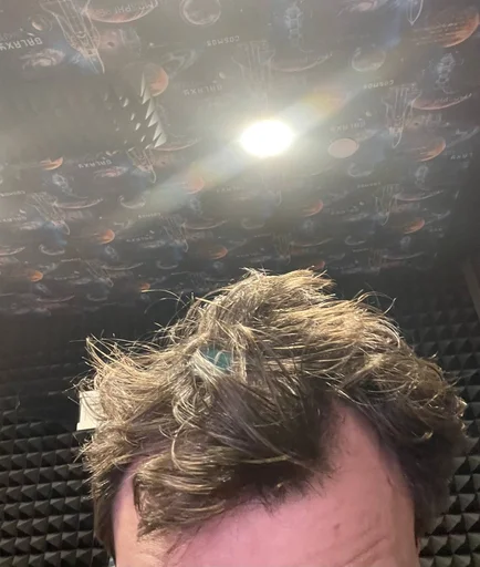 Стикер Самарская алопеция - 4