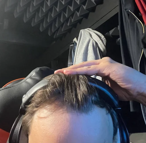 Стикер Самарская алопеция - 1