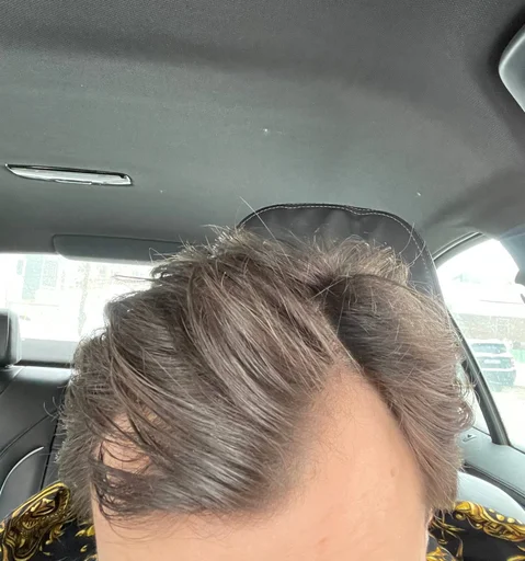 Стикер Самарская алопеция - 0