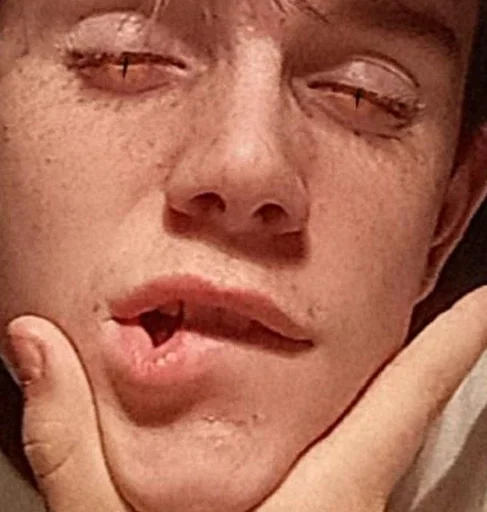 Человек человеческое лицо кожа