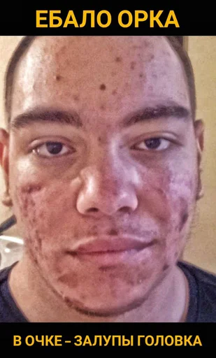 human face forehead man