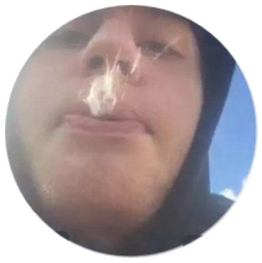 human face forehead cheek