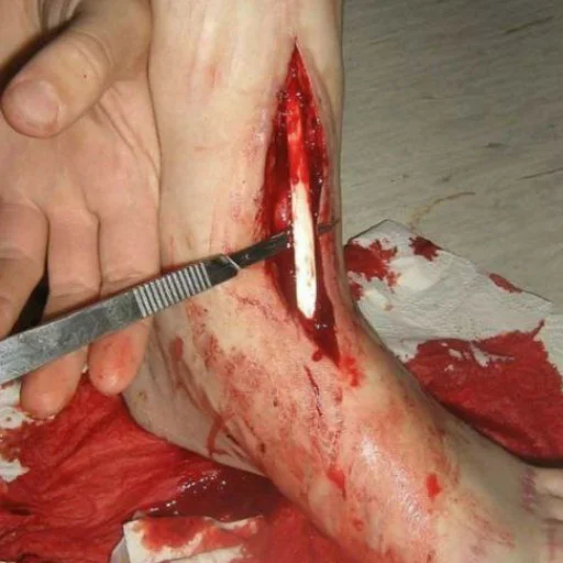 Sticker Raschlenenkaa - 1