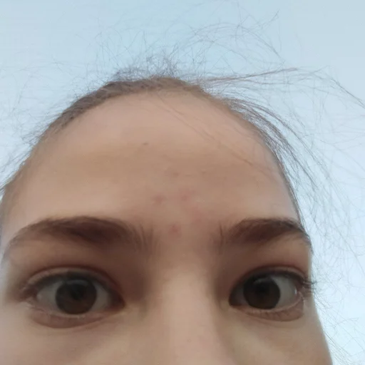 eyelash eyebrow skin