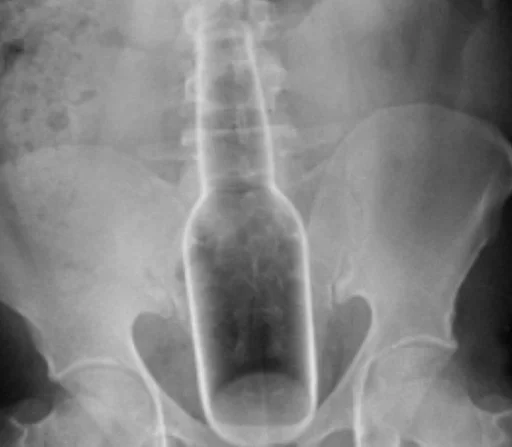 рентгеновская пленка медицинская визуализация рентгеновский