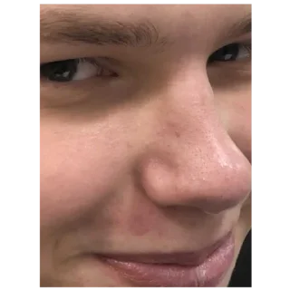 Стикер Рофланебало - 2