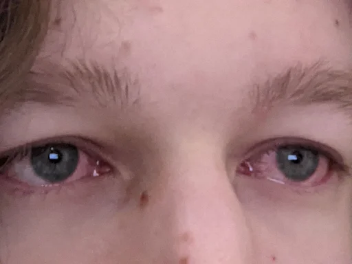 skin eyelash closeup