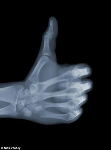 рентгеновская пленка медицинский медицинская визуализация