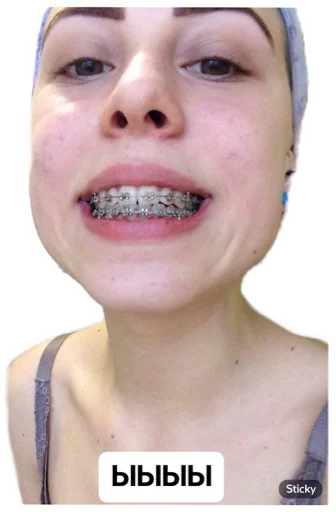 Sticker SonyaSpack PRO - 5