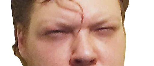 кожа лоб щека