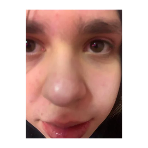 skin person human face