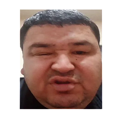 human face forehead man