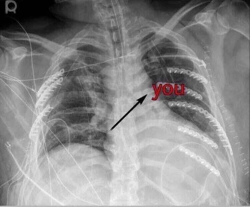 x-ray film medical imaging medical