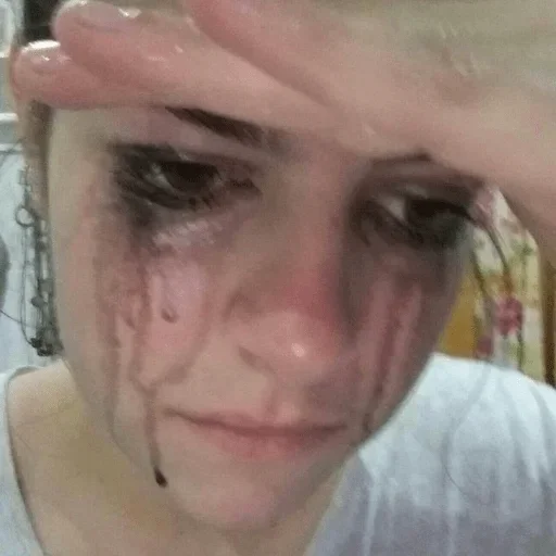 Человек кожа ресница