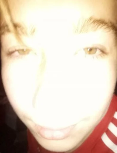 селфи Человек кожа