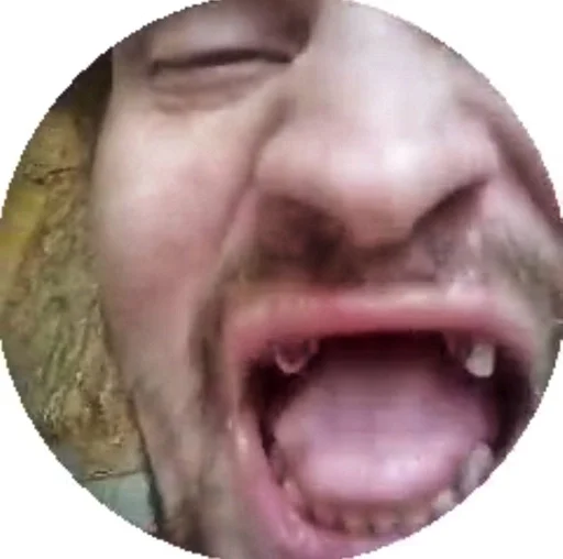 челюсть зуб кожа