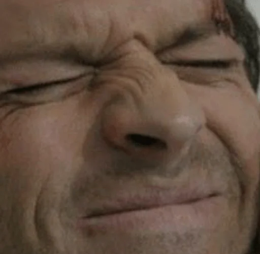 wrinkle human face forehead