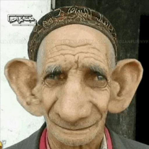 human face wrinkle forehead